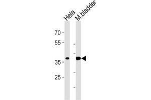 Western Blotting (WB) image for anti-Eukaryotic Translation Initiation Factor 3 Subunit H (EIF3H) antibody (ABIN3002723) (EIF3H Antikörper)