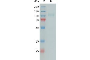 Complement Factor I (CFI) (AA 19-583) protein (His tag)