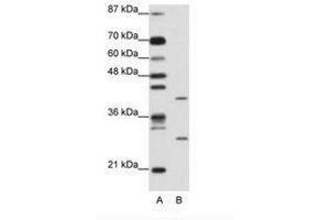 Image no. 1 for anti-ZFP36 Ring Finger Protein-Like 1 (ZFP36L1) (AA 46-95) antibody (ABIN202274) (ZFP36L1 Antikörper  (AA 46-95))