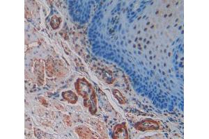 Used in DAB staining on fromalin fixed paraffin- embedded esophagus cancer tissue (SNCG Antikörper  (AA 1-121))