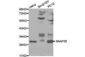 Western Blotting (WB) image for anti-Synaptosomal-Associated Protein, 25kDa (SNAP25) antibody (ABIN1874885) (SNAP25 Antikörper)
