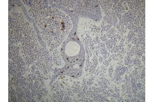 Immunohistochemistry (IHC) image for anti-CD1a (CD1a) (AA 240-256), (C-Term) antibody (ABIN870503) (CD1a Antikörper  (C-Term))