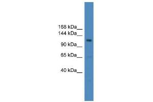 WB Suggested Anti-USP38 Antibody Titration: 0. (USP38 Antikörper  (Middle Region))