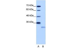 EIF4E2 antibody used at 2. (EIF4E2 Antikörper  (N-Term))