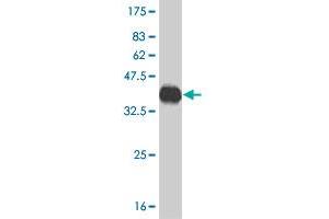 Western Blot detection against Immunogen (36. (CACNA1F Antikörper  (AA 1878-1977))