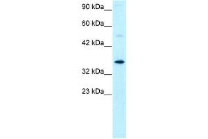 WB Suggested Anti-GTF2H3 Antibody Titration: 0. (GTF2H3 Antikörper  (N-Term))