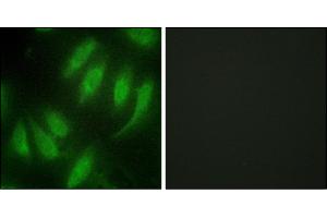 Immunofluorescence analysis of HeLa cells, using HES7 antibody. (HEXIM1 Antikörper)