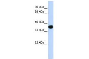 Image no. 1 for anti-T-Cell Leukemia Homeobox 1 (TLX1) (C-Term) antibody (ABIN6744378) (TLX1 Antikörper  (C-Term))