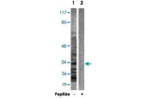 Western blot analysis of extracts from A-431 cells, using CASP6 polyclonal antibody . (Caspase 6 Antikörper)