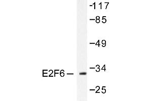 Image no. 1 for anti-E2F Transcription Factor 6 (E2F6) antibody (ABIN265390) (E2F6 Antikörper)