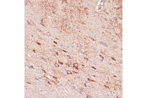Immunohistochemistry of paraffin-embedded rat brain using OR10H3 antibody (ABIN7269086) at dilution of 1:100 (40x lens). (OR10H3 Antikörper  (AA 1-100))