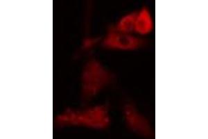ABIN6274091 staining Hela cells by IF/ICC. (NDC80 Antikörper  (C-Term))