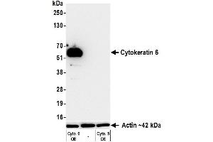 Western Blotting (WB) image for anti-Keratin 6 (KRT6) (C-Term) antibody (ABIN7795793)