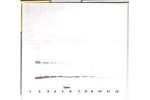 Image no. 5 for anti-Interleukin 1 alpha (IL1A) antibody (ABIN465571) (IL1A Antikörper)