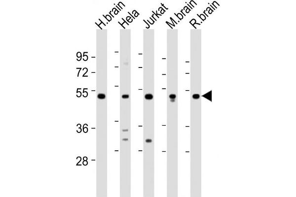 CHST1 Antikörper  (C-Term)