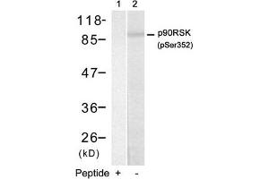 Western blot analysis of extracts from HUVEC cells using p90RSK(Phospho-Ser352) Antibody(Lane 2) and the same antibody preincubated with blocking peptide(Lane1). (RPS6KA1 Antikörper  (pSer352))