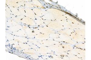Phospho-Rab8 (Thr72) Antibody at 1/100 staining Rat skin tissue by IHC-P.