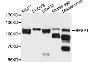 Western blot analysis of extracts of various cell lines, using BFSP1 antibody (ABIN5971950) at 1/1000 dilution.