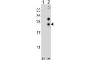 Western Blotting (WB) image for anti-Casein alpha S1 (CSN1S1) antibody (ABIN2997019) (Casein alpha S1 Antikörper)