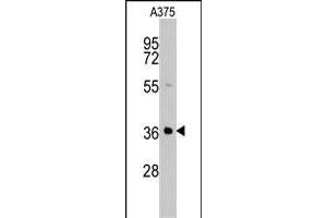 Western blot analysis of AKR1B1 polyclonal antibody  in A-375 cell line lysates (35 ug/lane). (AKR1B1 Antikörper  (C-Term))