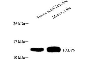 Western blot analysis of FABP6 (ABIN7073921) at dilution of 1: 1000 (FABP6 Antikörper)