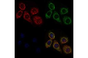 ABIN6258351 and ABIN6275664 staining HepG2 cells by IF/ICC. (UBE2D2 Antikörper  (C-Term))