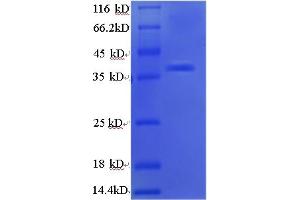 SDS-PAGE (SDS) image for Apurinic/Apyrimidinic Endonuclease 1 (APEX1) (AA 32-318) protein (His tag) (ABIN5713236)
