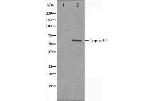 Western blot analysis on HeLa cell lysate using Caspase 10 Antibody,The lane on the left is treated with the antigen-specific peptide. (Caspase 10 Antikörper)