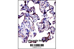 Immunohistochemistry (IHC) image for anti-Potassium Voltage-Gated Channel, Shaker-Related Subfamily, Member 2 (KCNA2) (AA 451-479), (C-Term) antibody (ABIN5533116)