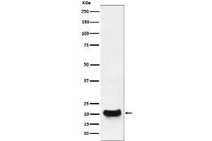 Western blot analysis of DCTN5 expression in MCF7 cell lysate.