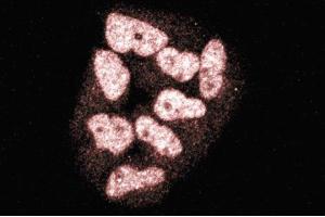 Immunofluorescence staining of HeLa cells (Human cervical epitheloid carcinoma, ATCC CCL-2. (TOPBP1 Antikörper  (AA 204-416))