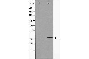 Western blot analysis of extracts of HeLa , using NQO2 antibody. (NQO2 Antikörper  (N-Term))