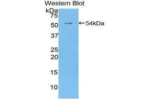 Western Blotting (WB) image for anti-Epidermal Growth Factor Receptor 2 (EGFR2) (AA 376-578) antibody (FITC) (ABIN1175126) (EGFR2 Antikörper  (AA 376-578) (FITC))