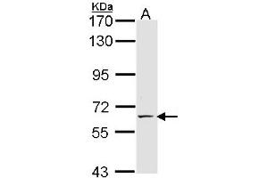 Western Blotting (WB) image for anti-Selectin E (SELE) (AA 278-506) antibody (ABIN467628) (Selectin E/CD62e Antikörper  (AA 278-506))