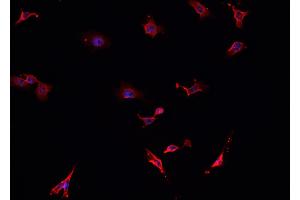 ABIN6276804 staining HepG2? (TAC1 Antikörper  (N-Term))