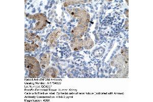 Human kidney (ZMYM6 Antikörper  (Middle Region))