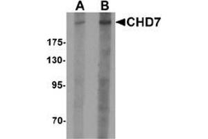 Western blot analysis of CHD7 in SK-N-SH cell lysate with CHD7 antibody at (A) 1 and (B) 2 ug/mL. (CHD7 Antikörper  (N-Term))