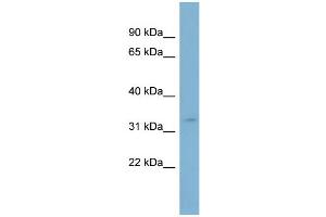 WB Suggested Anti-SLC25A20  Antibody Titration: 0.
