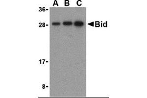 Western Blotting (WB) image for anti-BH3 Interacting Domain Death Agonist (BID) (C-Term) antibody (ABIN1030296) (BID Antikörper  (C-Term))