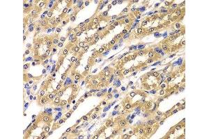 Immunohistochemistry of paraffin-embedded Mouse kidney using UBA3 Polyclonal Antibody at dilution of 1:100 (40x lens).