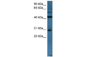 WB Suggested Anti-TLX2 Antibody Titration: 0. (TLX2 Antikörper  (N-Term))