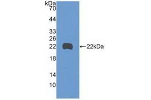 Detection of Recombinant GADD45b, Human using Polyclonal Antibody to Growth Arrest And DNA Damage Inducible Protein Beta (GADD45b) (GADD45B Antikörper  (AA 1-160))