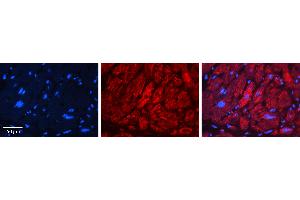 Immunohistochemistry (IHC) image for anti-Fibulin 3 (FBLN3) (Middle Region) antibody (ABIN2776823)