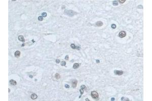 Immunohistochemistry (IHC) image for anti-Interleukin enhancer-binding factor 3 (ILF3) (AA 672-891) antibody (ABIN7442864)