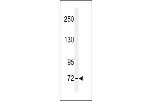 Western blot analysis of IL1RL2 Antibody (Center) 8817c in K562 cell line lysates (35 μg/lane). (IL1RAPL2 Antikörper  (AA 372-401))