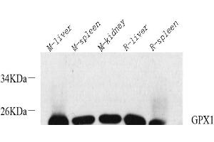 Western Blot analysis of various samples using GPX1 Polyclonal Antibody at dilution of 1:1000. (Glutathione Peroxidase 1 Antikörper)
