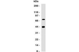 Western blot testing of human skeletal muslce with Muscle Actin antibody.