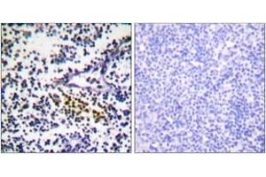 Immunohistochemistry analysis of paraffin-embedded human tonsil tissue, using NYREN18 Antibody. (NUB1 Antikörper  (AA 566-615))