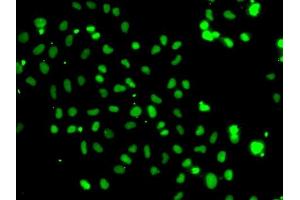 Immunofluorescence analysis of A-549 cells using HMG20A antibody (ABIN6130458, ABIN6141856, ABIN6141857 and ABIN6223115). (HMG20A Antikörper  (AA 1-347))