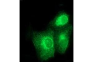 Image no. 2 for anti-Bone Morphogenetic Protein 1 (BMP1) (AA 225-617) antibody (ABIN1491232)